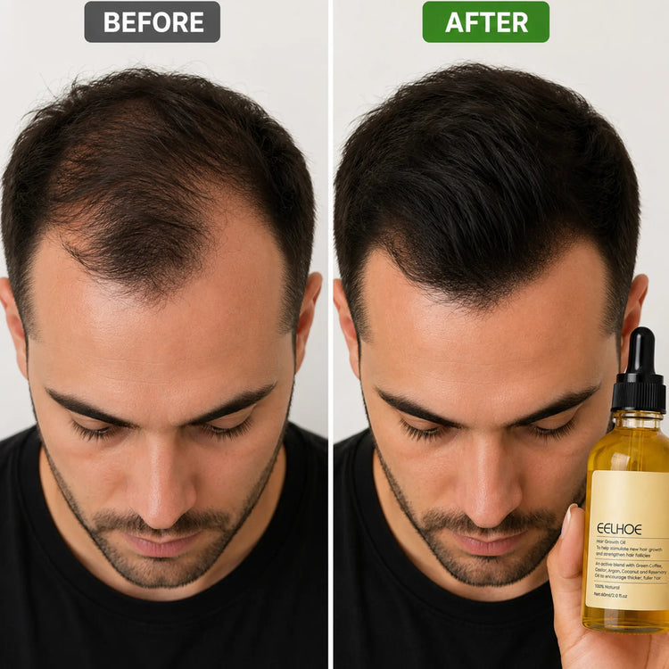 Eelhoe Rosemary Hair Oil bottle with rosemary sprigs, promoting hair growth and healthy hair in a natural hair care setting.
