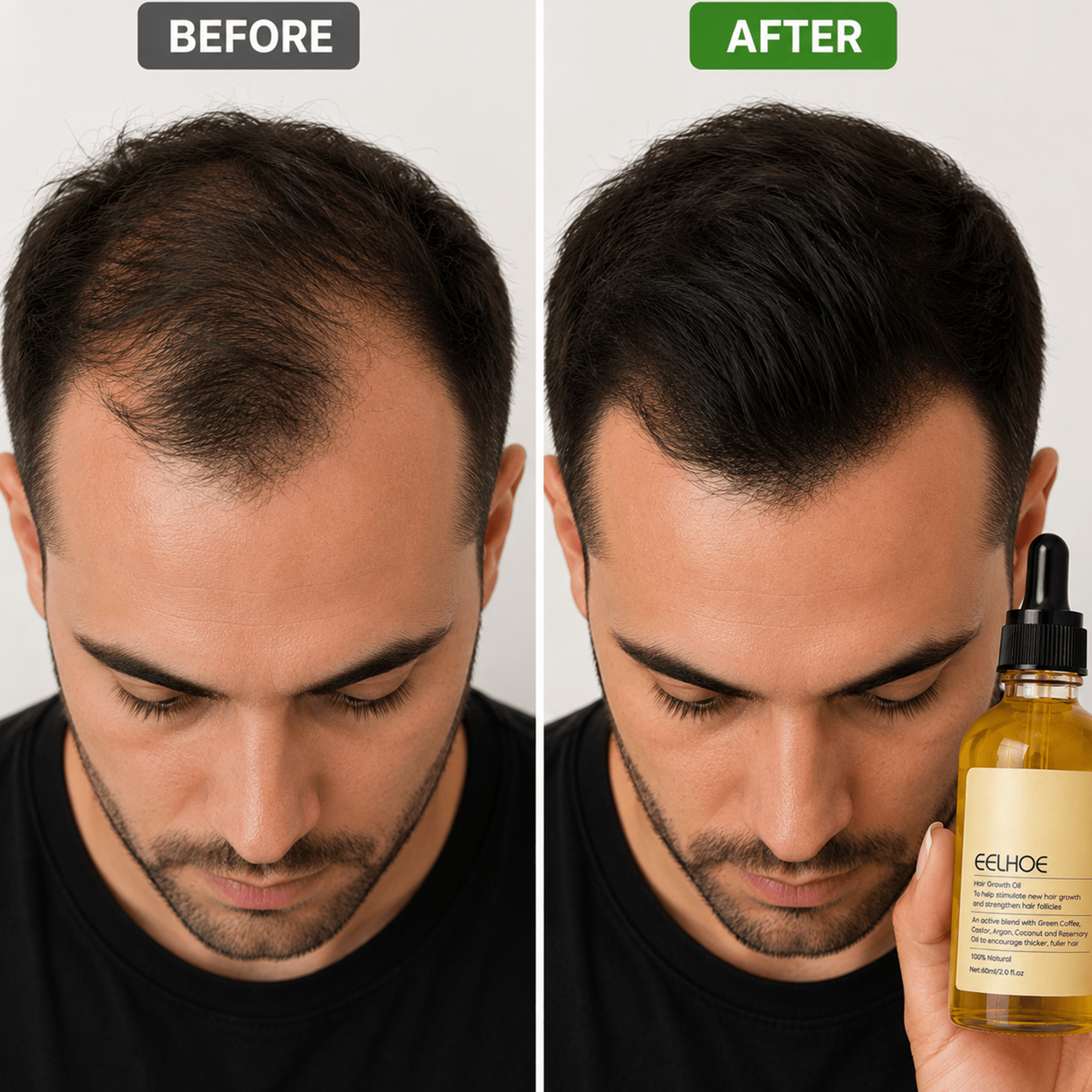 Rosemary Hair Oil by Eelhoe Care - Hair Care